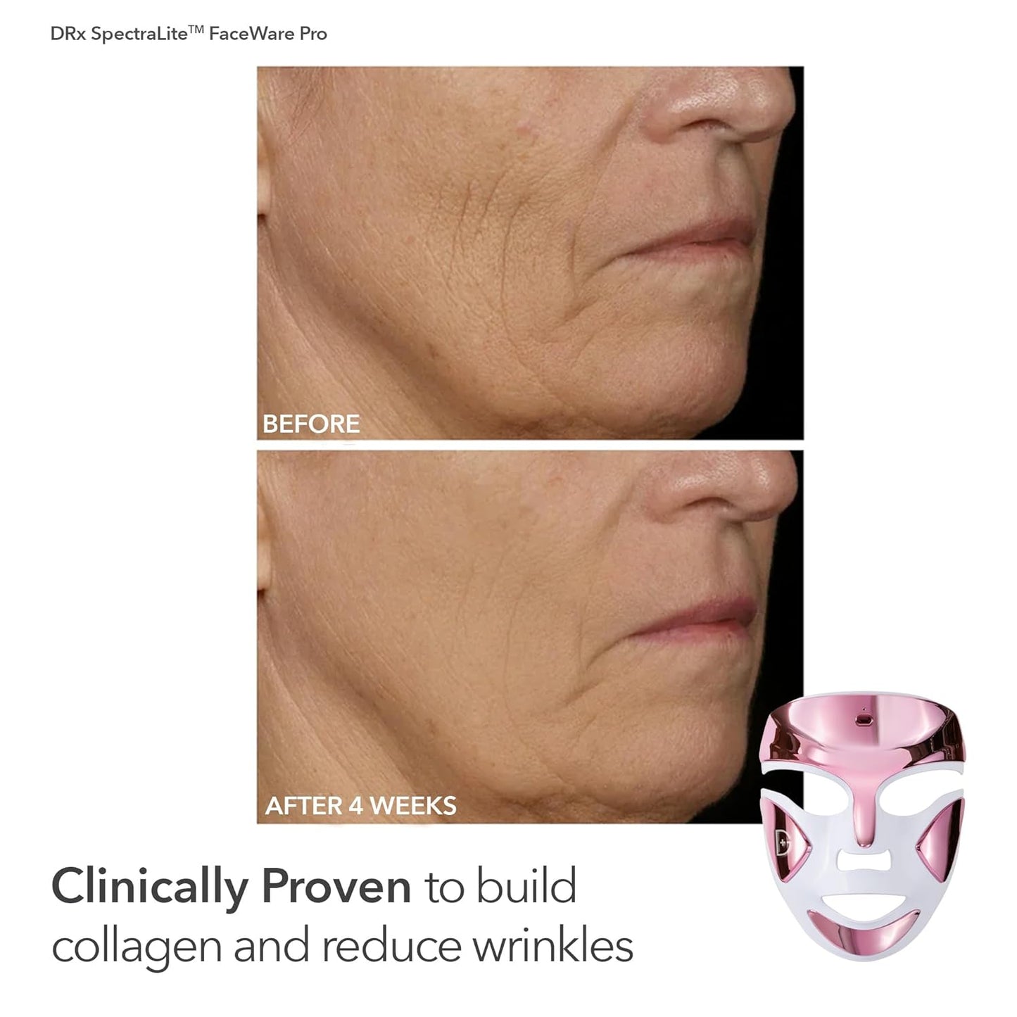 Dr. Dennis Gross Boost Collagen, Brighten & Firm Kit – Pink dpl Faceware Pro LED Device + Cleansing Oil + Dewy Deep Cream + 5 Universal Daily Peels | $592 Value Limited Edition Gift Set