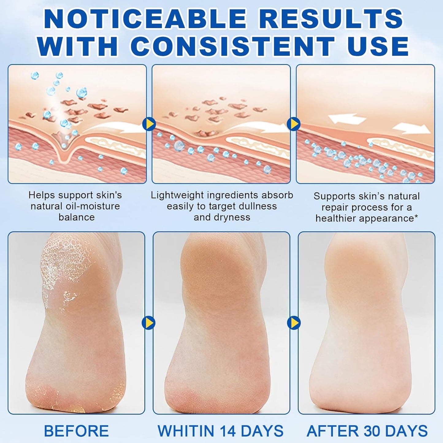 60% Urea Foot Care Stick with 2% Salicylic Acid, Foot Cream Moisturizer for Dry Cracked Feet, Knees, Elbows, Hands,Exfoliating Moisturizer, Dead Skin Remover Foot Balm 1.4oz