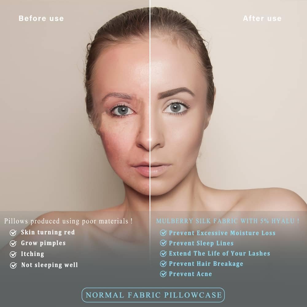 100% Mulberry Silk Pillowcases with Zipper– Luxurious, Anti-Aging Pillow Covers, 22 Momme 6A Grade Silk Pillow Cases 2 Pack for Hair and Skin Care (Silver Grey, Standard)