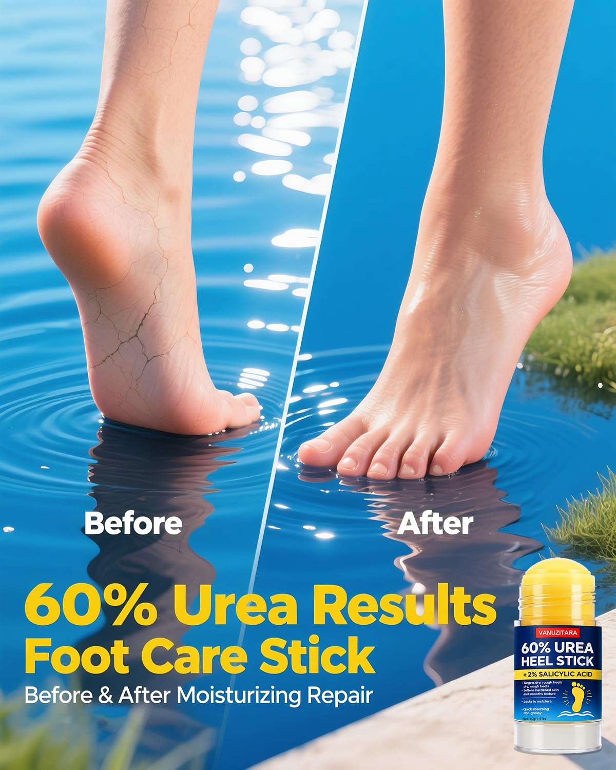 Urea Cream 60% with 2% Salicylic Acid, Foot Cream 60 Percent for Feet & Hands, Maximum Strength Urea Stick for Rough, Dry Cracked Feet Hands Elbows, Callus Remover, Skin Softener Balm 1.41oz