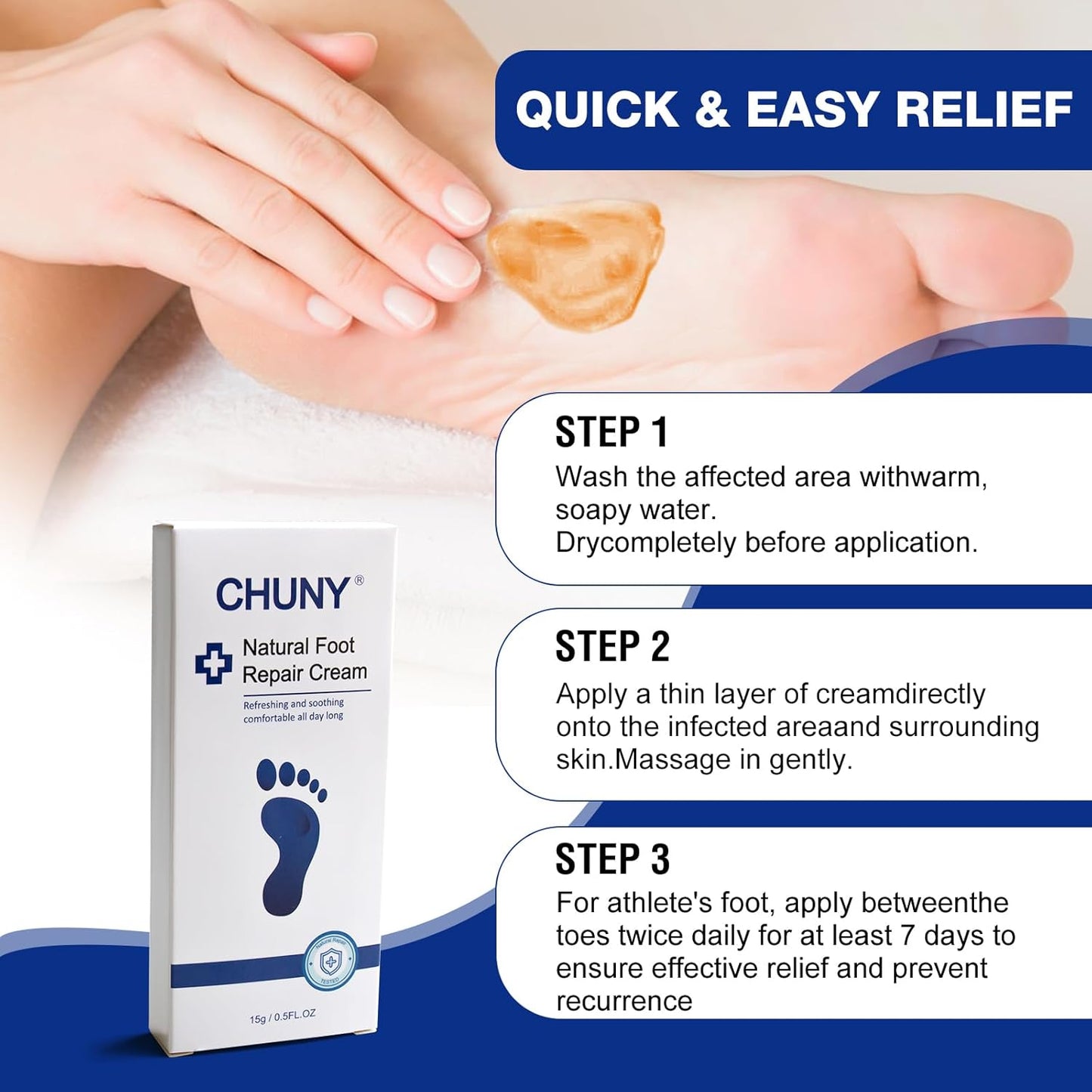 CHUNY Foot Cream for Cracked Heels Cream - Extra Strength for Cracked Heels, Dry Skin & Itchy Feet – Soothes Burning, Scaling & Irritation for Men and Women
