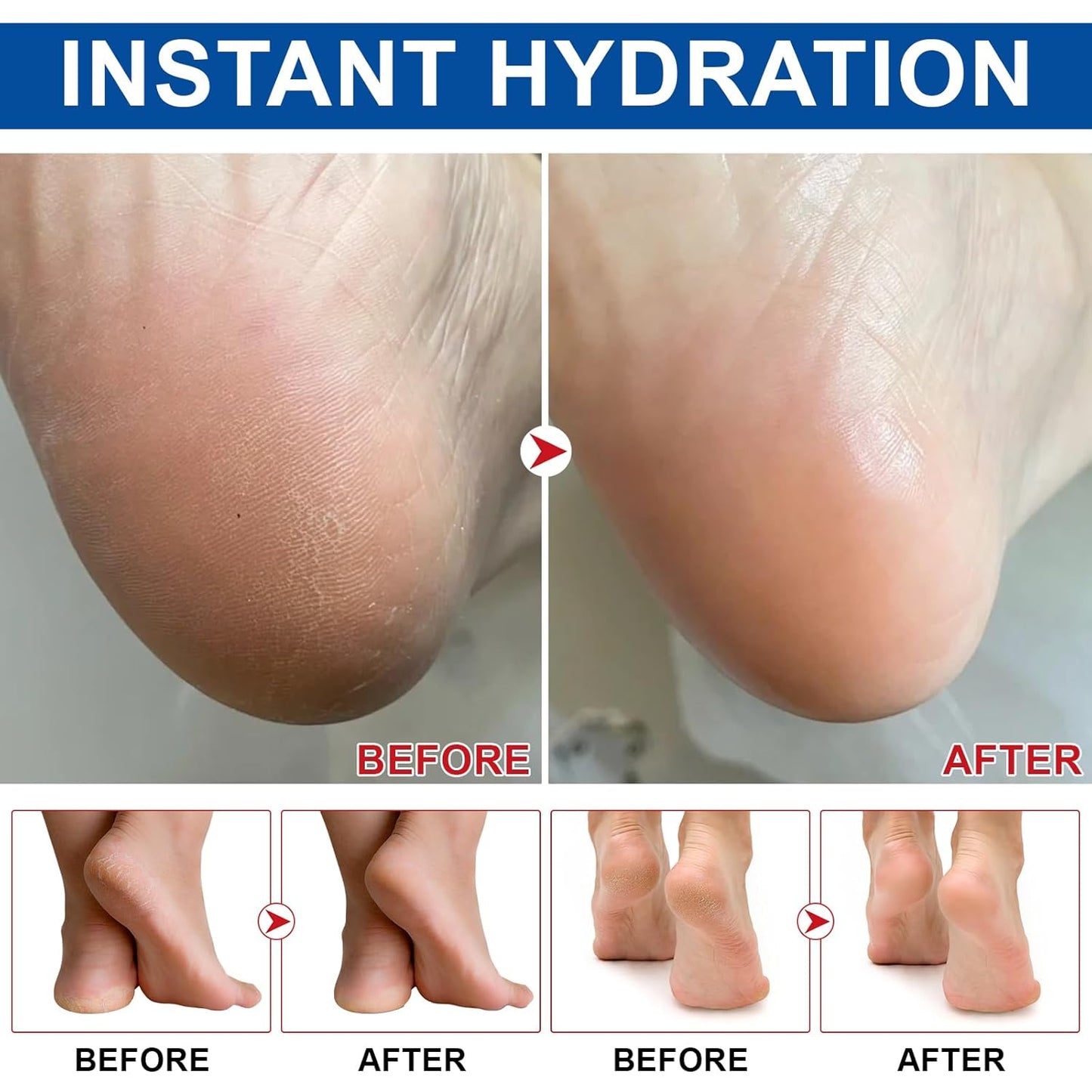 Urea Cream Stick 60% plus Salicylic Acid 2%, Maximum Strength Urea Foot Cream for Dry Cracked Feet, Knees, Hands, Exfoliating Dead Skin, Repairs and Hydrates Feet, Foot Care Cream Moisturizer 2 PCS