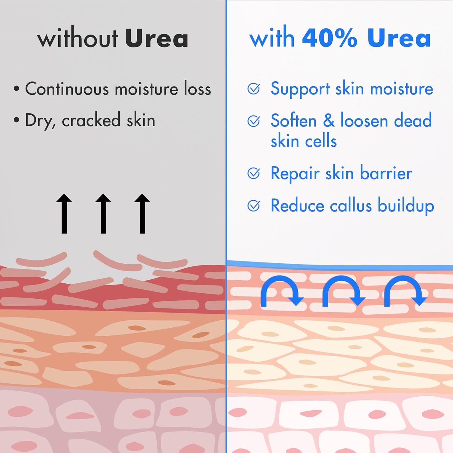 Ebanel Urea Cream 40% plus Salicylic Acid 2%, Foot Cream for Dry Cracked Heels Feet Knees Elbows Hands, Foot Dead Skin Cuticle Callus Remover Toenail Softener, Keratolytic Skin Barrier Repair, 6-Pack