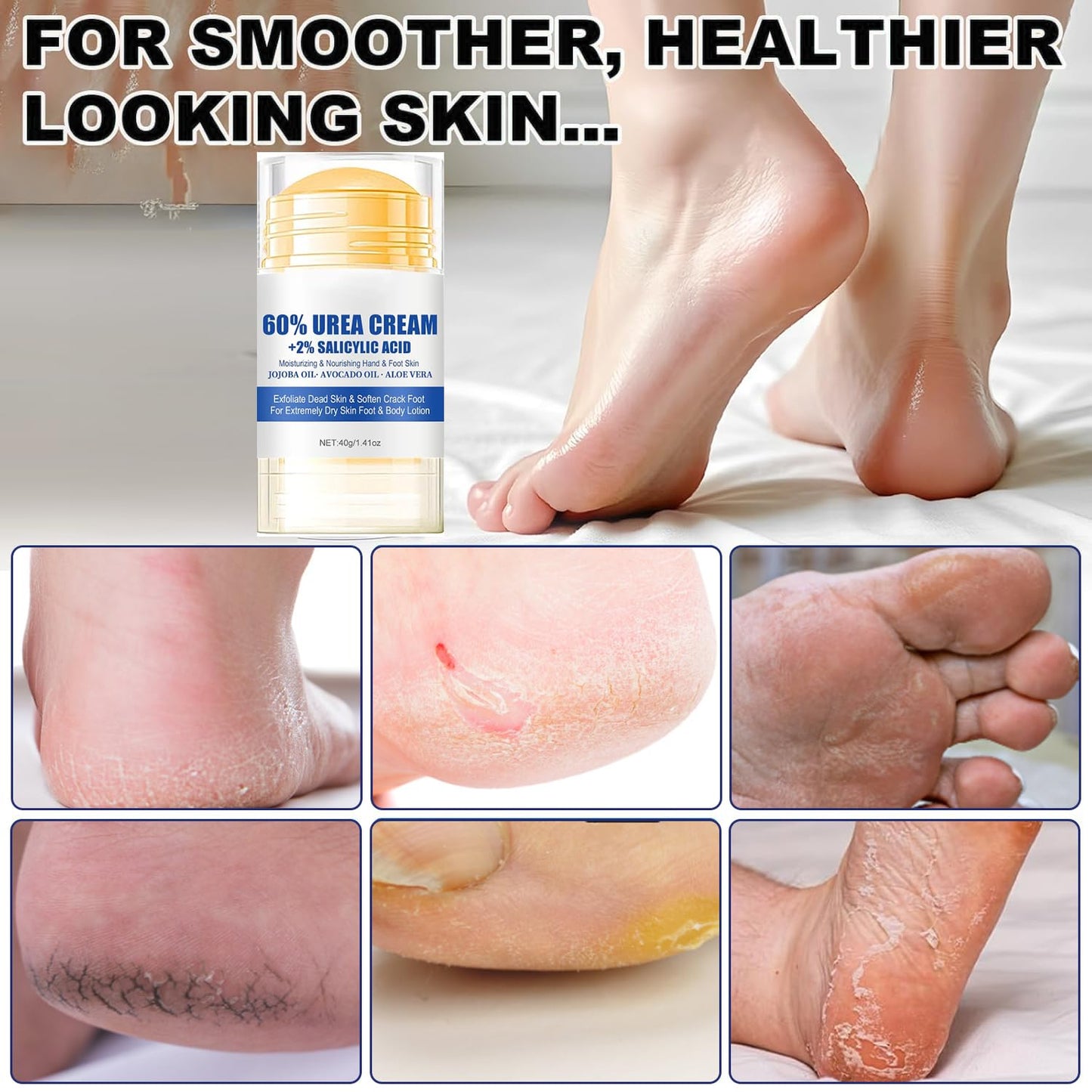 60% Urea Foot Cream Care Stick for Feet Plus 2% Salicylic Acid, 2026 New Urea Heel Stick Cream 60 Percent Foot Callus Remover Cream for Feet Maximum Strength, for Dry Cracked Heels, Hands, Knees (2)