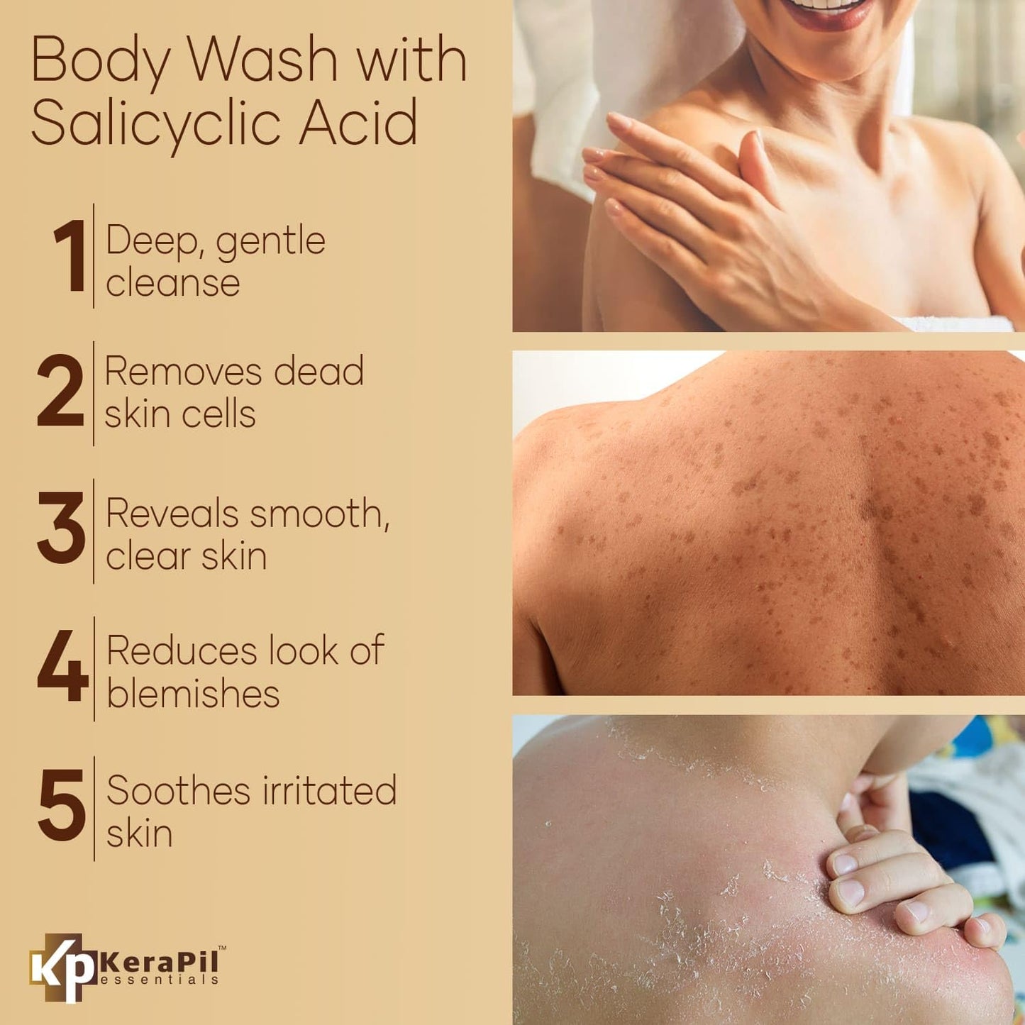 Exfoliating Body Wash with Salicylic Acid - No Dry Out, Gentle Exfoliates Rough and Bumpy Skin, Body Acne Wash, BHA & AHA - Coconut and Vanilla with Salicylic Acid - (16 fl oz)