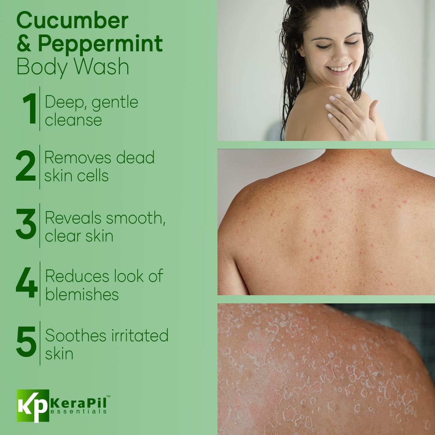 Exfoliating Body Wash with Salicylic Acid - No Dry Out, Gentle Exfoliates Rough and Bumpy Skin, Body Acne Wash, BHA & AHA - Cucumber and Mint Salicylic Acid Body Wash - (16 fl oz)
