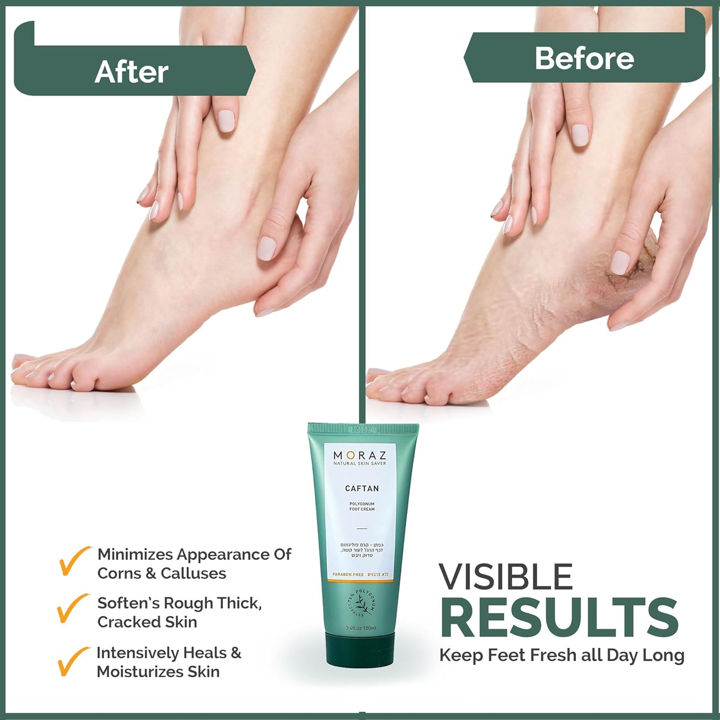 Moraz Caftan Polygonum Foot Cream for Dry Cracked Heels and Feet with 75% Polygonum Extract – Non-greasy, Fast-absorbing Intensive Foot Moisturizer for Dry Cracked Feet, Vegan, Paraben Free, 3.4 Fl Oz