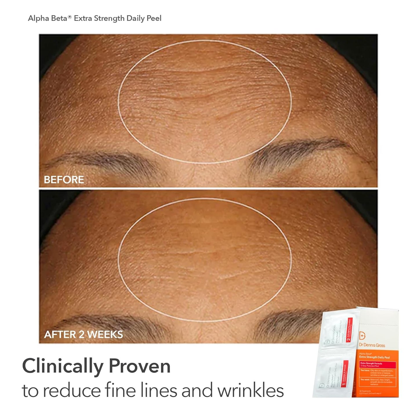 Dr Dennis Gross Peel Vault Kit – 30 Alpha Beta® Extra Strength Daily Peels + 60 Universal Daily Peels | 90 Total Treatments | $245 Value Limited Edition