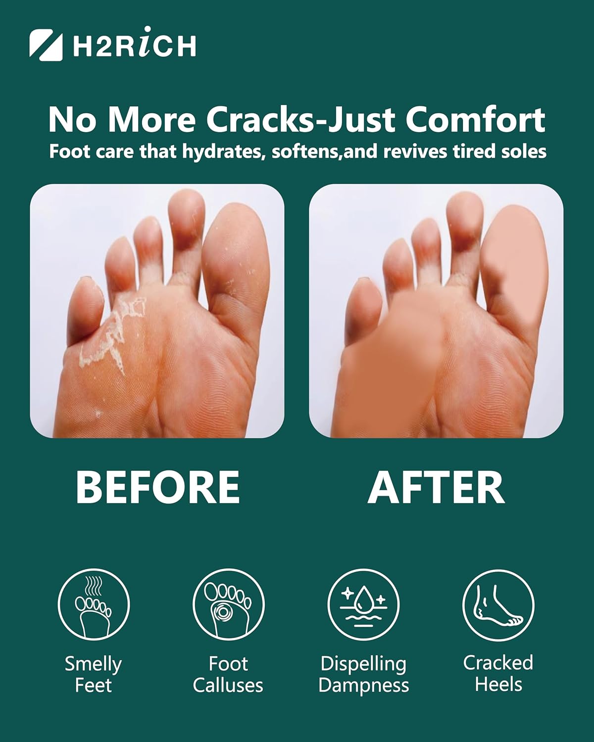 Hydrogen Foot Soak Effervescent Tablets 2 Pieces | Ginger & Mugwort Herb Foot Bath, Relaxing Spa Pedicure Care | Improves Circulation, Soothes Tired Feet, Softens Calluses, Controls Odor