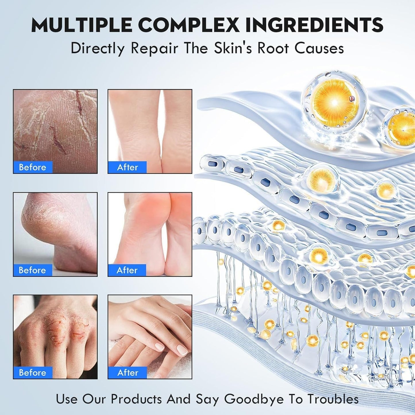 Urea Cream 40% Percent Foot Care Plus 2% Salicylic Acid 3.52 Fluid oz,Foot and Hand Cream Maximum Strength with Aloe Vera and Shea Butter,for calluses and Dry – 2-Pack