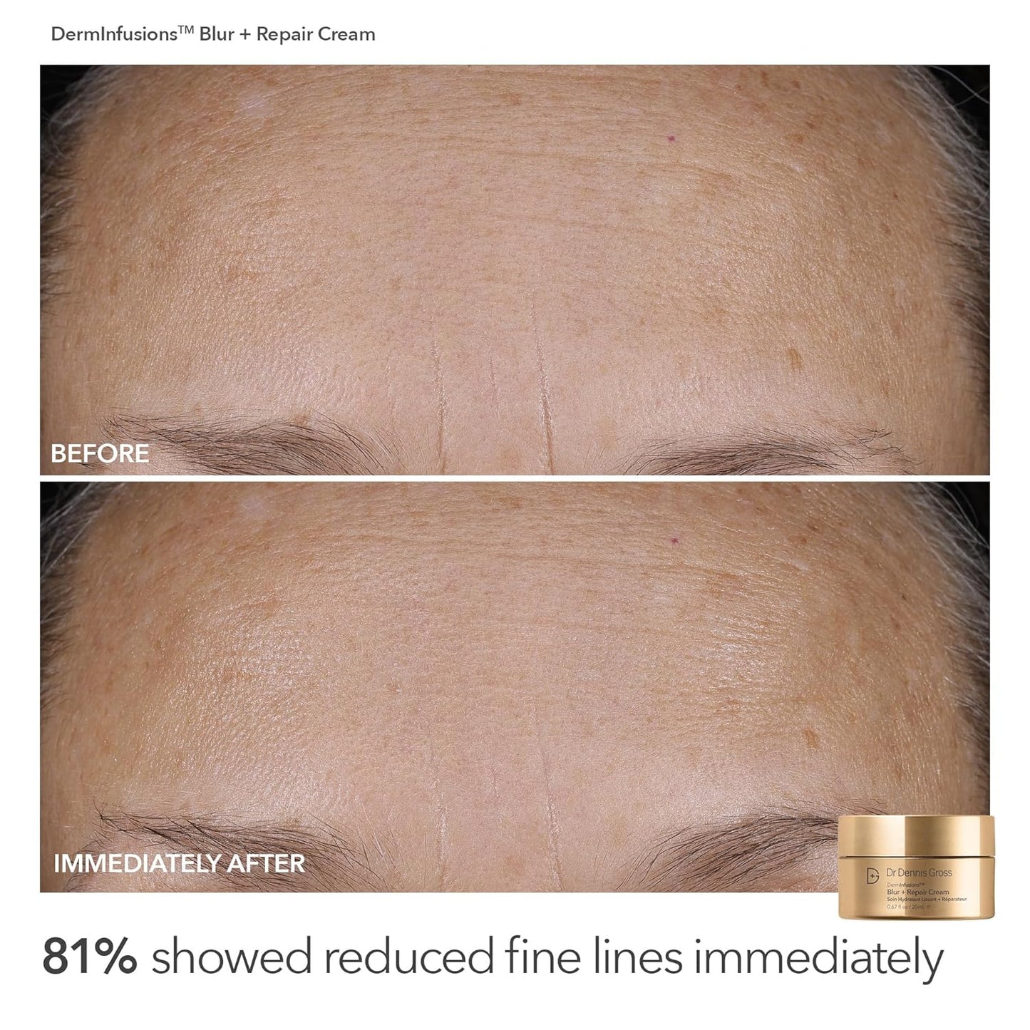 Dr Dennis Gross Plump & Smooth Limited Edition Kit – DermInfusions™ Blur + Repair Cream (0.67 oz) + 5 Alpha Beta® Universal Daily Peels | $50 Value